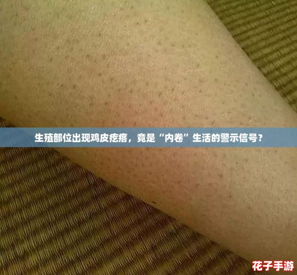 生殖部位出现鸡皮疙瘩，竟是“内卷”生活的警示信号？