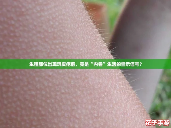 生殖部位出现鸡皮疙瘩，竟是“内卷”生活的警示信号？