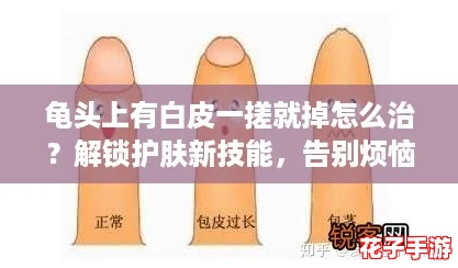龟头上有白皮一搓就掉怎么治？解锁护肤新技能，告别烦恼！