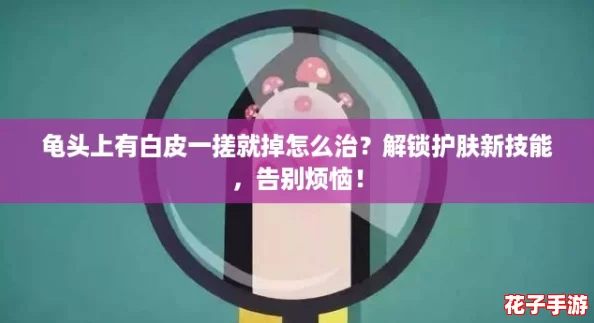 龟头上有白皮一搓就掉怎么治?解锁护肤新技能,告别烦恼! 龟头上有白皮一搓就掉怎么治?解锁护肤新技能,告别烦恼!