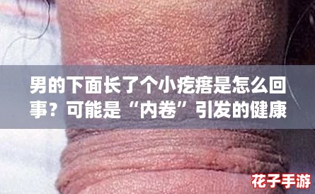 男的下面长了个小疙瘩是怎么回事？可能是“内卷”引发的健康警示！
