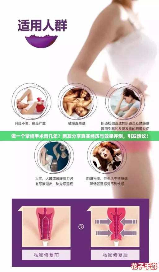 做一个紧缩手术管几年？网友分享真实经历与效果评测，引发热议！