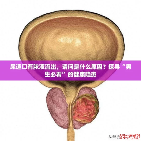 尿道口有脓液流出，请问是什么原因？探寻“男生必看”的健康隐患