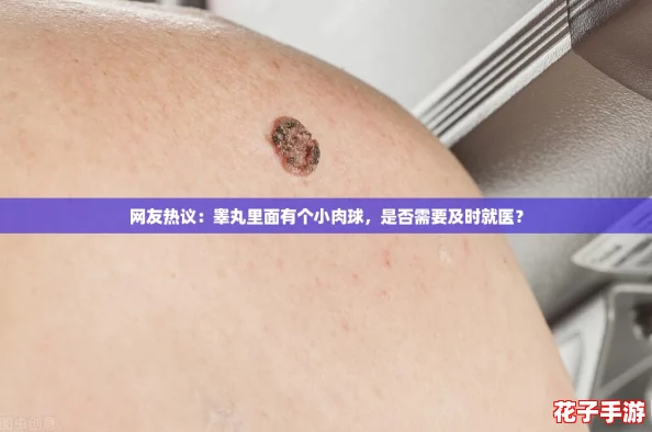 网友热议：睾丸里面有个小肉球，是否需要及时就医？