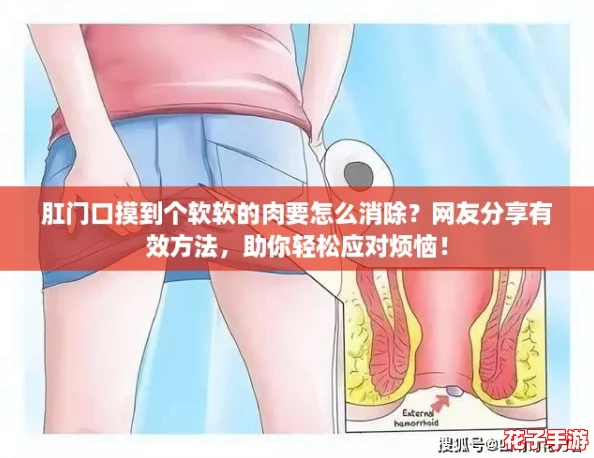 肛门口摸到个软软的肉要怎么消除？网友分享有效方法，助你轻松应对烦恼！