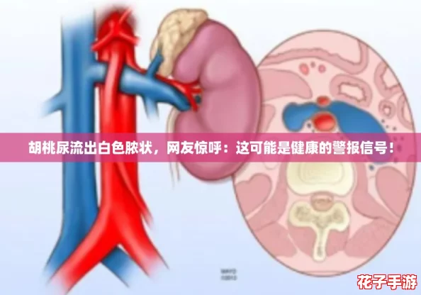 胡桃尿流出白色脓状,网友惊呼:这可能是健康的警报信号! 胡桃尿流出白色脓状,网友惊呼:这可能是健康的警报信号!