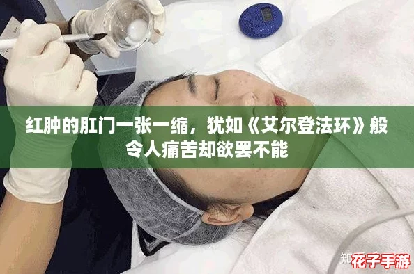 红肿的肛门一张一缩，犹如《艾尔登法环》般令人痛苦却欲罢不能