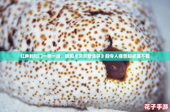 红肿的肛门一张一缩，犹如《艾尔登法环》般令人痛苦却欲罢不能