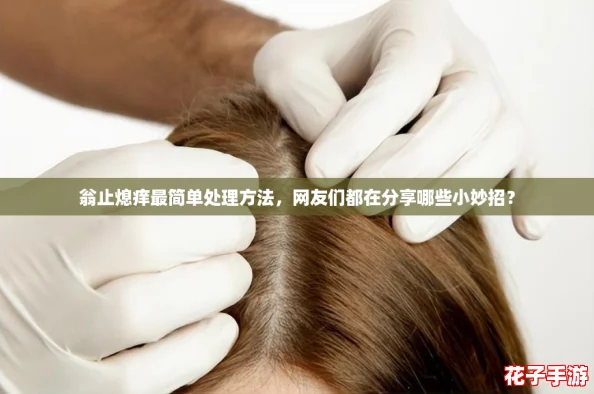 翁止熄痒最简单处理方法，网友们都在分享哪些小妙招？