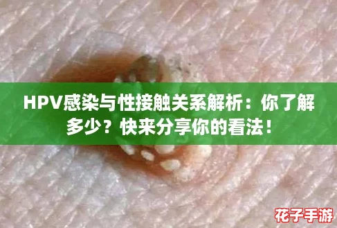 HPV感染与性接触关系解析：你了解多少？快来分享你的看法！