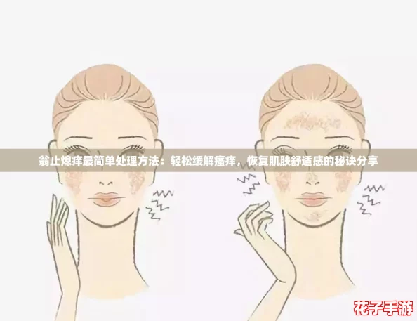 翁止熄痒最简单处理方法：轻松缓解瘙痒，恢复肌肤舒适感的秘诀分享