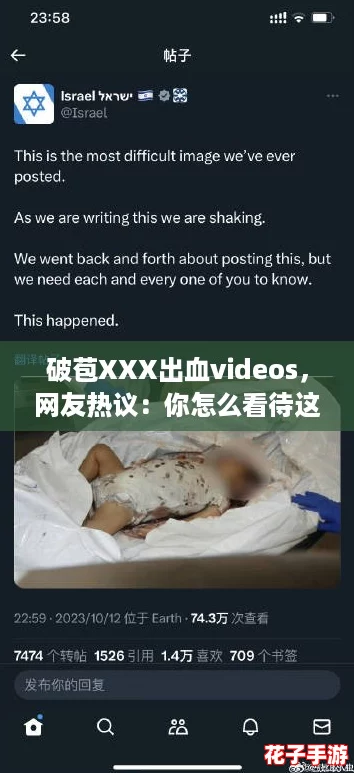 破苞XXX出血videos,网友热议:你怎么看待这种现象? 破苞XXX出血videos,网友热议:你怎么看待这种现象?
