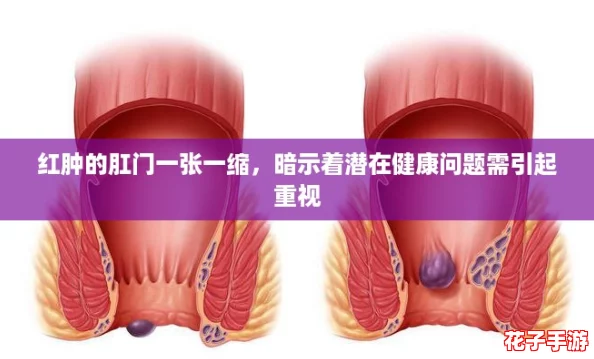 红肿的肛门一张一缩，暗示着潜在健康问题需引起重视